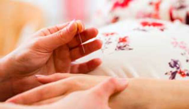Acupuncture